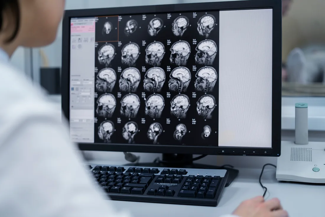 Doctor reviewing CT scan