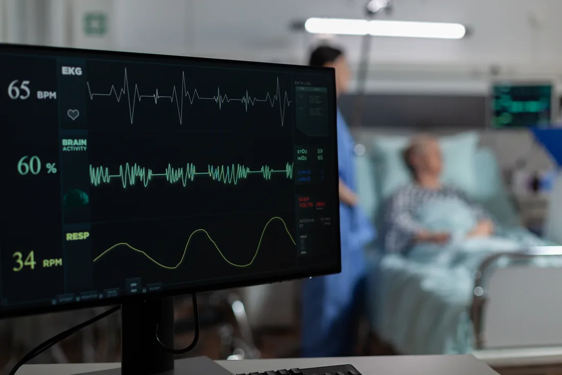 Hospital monitor visual
